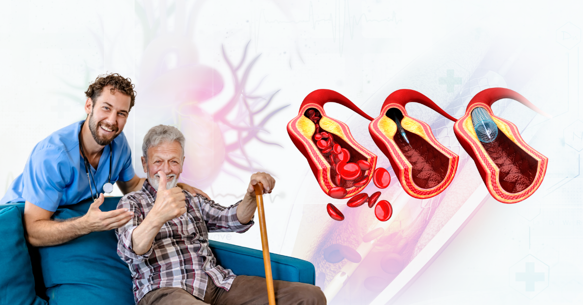 Quality of Life After Balloon Angioplasty